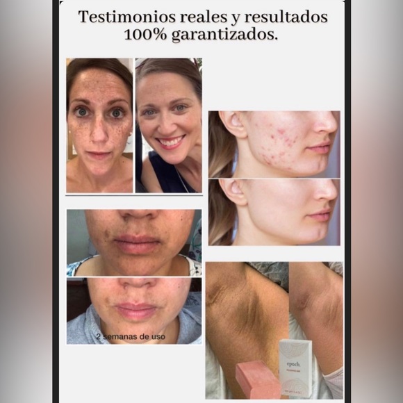 Exfoliating bar - Picture 2 of 5